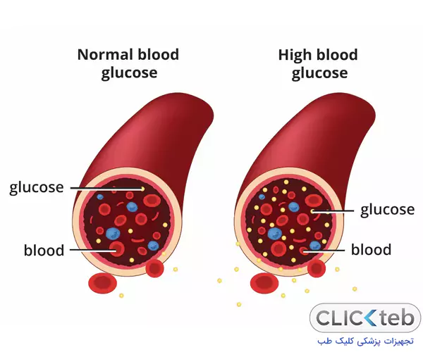 قند خون چیست